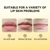 Propolis Gel Lip Balm - Image 5