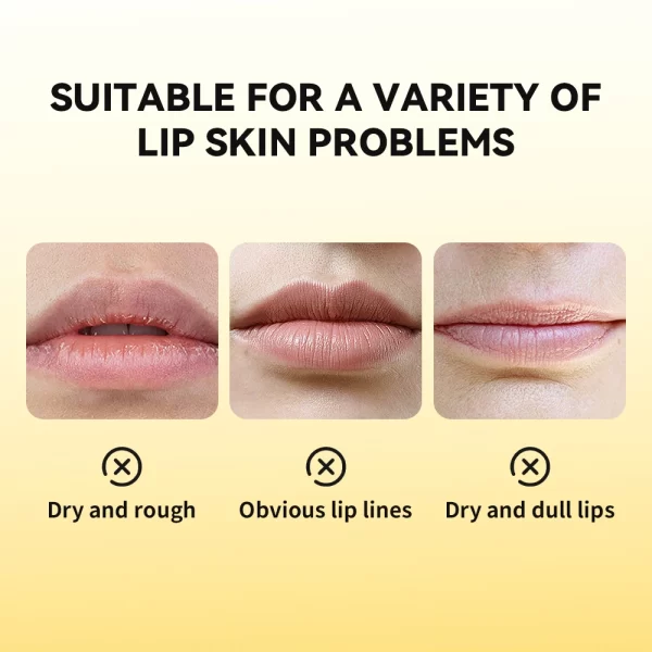 Propolis Gel Lip Balm - Image 5