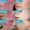 LAIKOU Rosacea Soothing Serum - Image 4