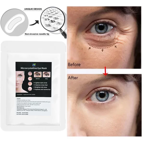 Microneedle Anti-Aging Eye Patches - Image 3