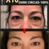Private Label Firming Eye Cream - Image 2