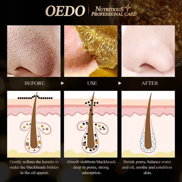 OEDO Gold Blackhead Removing Mask - Image 4