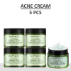 JOYPRETTY Herbal Acne Cream - Image 6